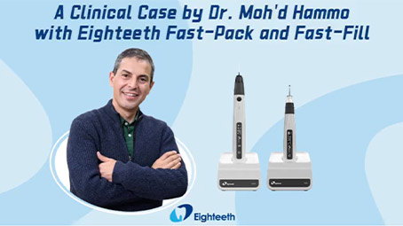 A Clinical Case by Dr. Moh'd Hammo with Eighteeth Fast-Pack and Fast-Fill