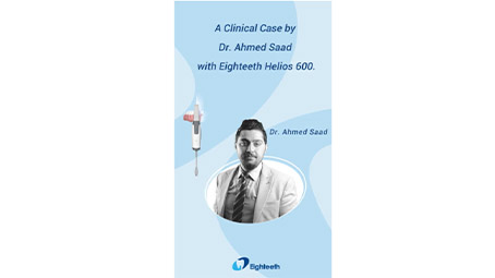 A Clinical Case by Dr. Ahmed Saad with Eighteeth Helios 600