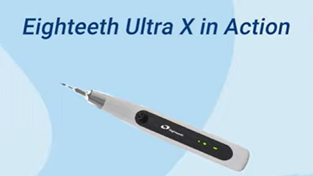 A Clinical Case by Dr. Ibrahim El Naggar with Eighteeth Ultra X
