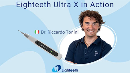 A Clinical Case by Dr. Riccardo Tonini with Eighteeth Ultra X