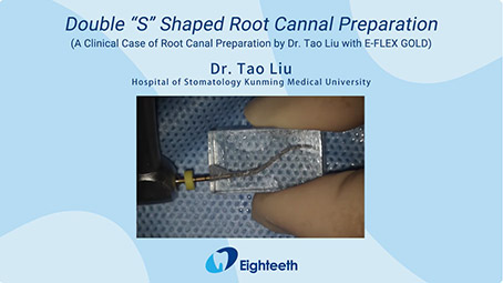 A Clinical Case of Root Canal Preparation by Dr. Tao Liu with E-FLEX GOLD