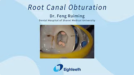 A Clinical Case of Root Canal Obturation by Dr. Ruiming Feng with Fast-Pack Pro