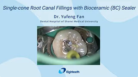 Single-cone Root Canal Fillings with Bioceramic (BC) Sealer by Dr. Yufeng Fan
