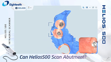 Helios 500 Can Scan Abutment Smoothly