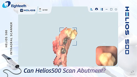 Helios 500 Can Scan Healing Cap Smoothly