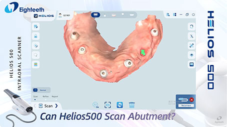 Helios 500 Can Scan Abutment Smoothly