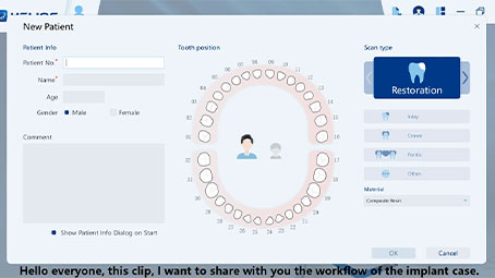 Implant Case Workflow