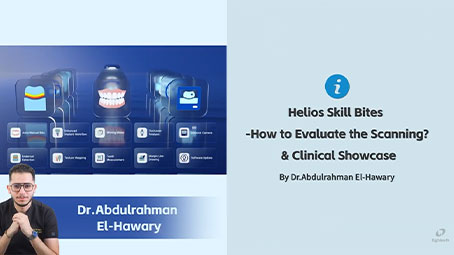 Helios Skill Bites: How to Evaluate the Scanning? & Clinical Showcase