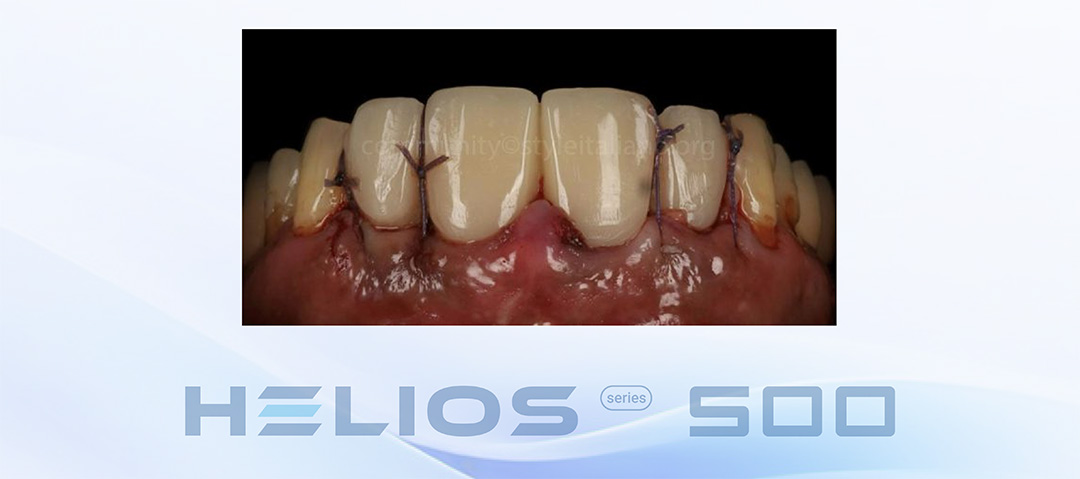 EN18期casebook-10_2