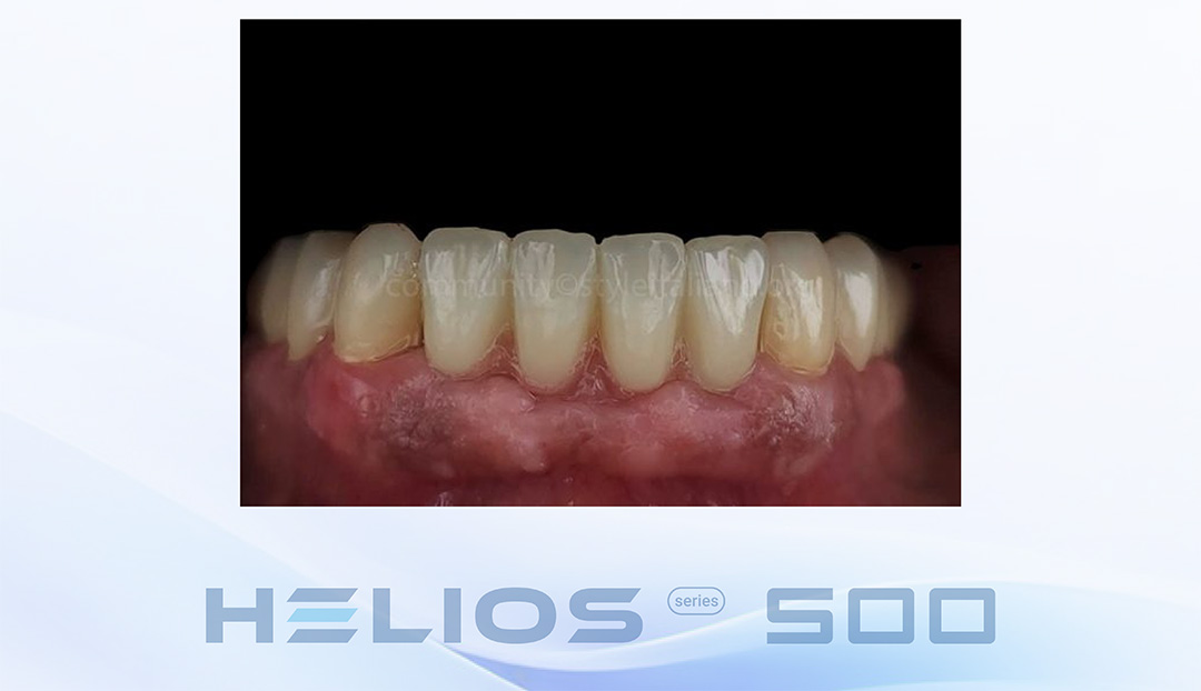 EN18期casebook-15_2