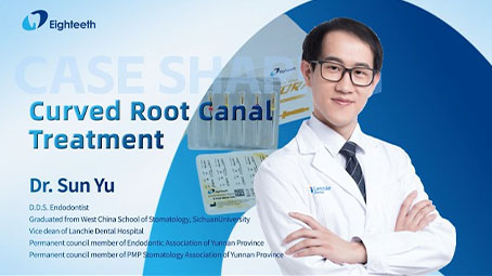 Curved Root Canal Treatment by Dr. Sun Yu with AURORA Files