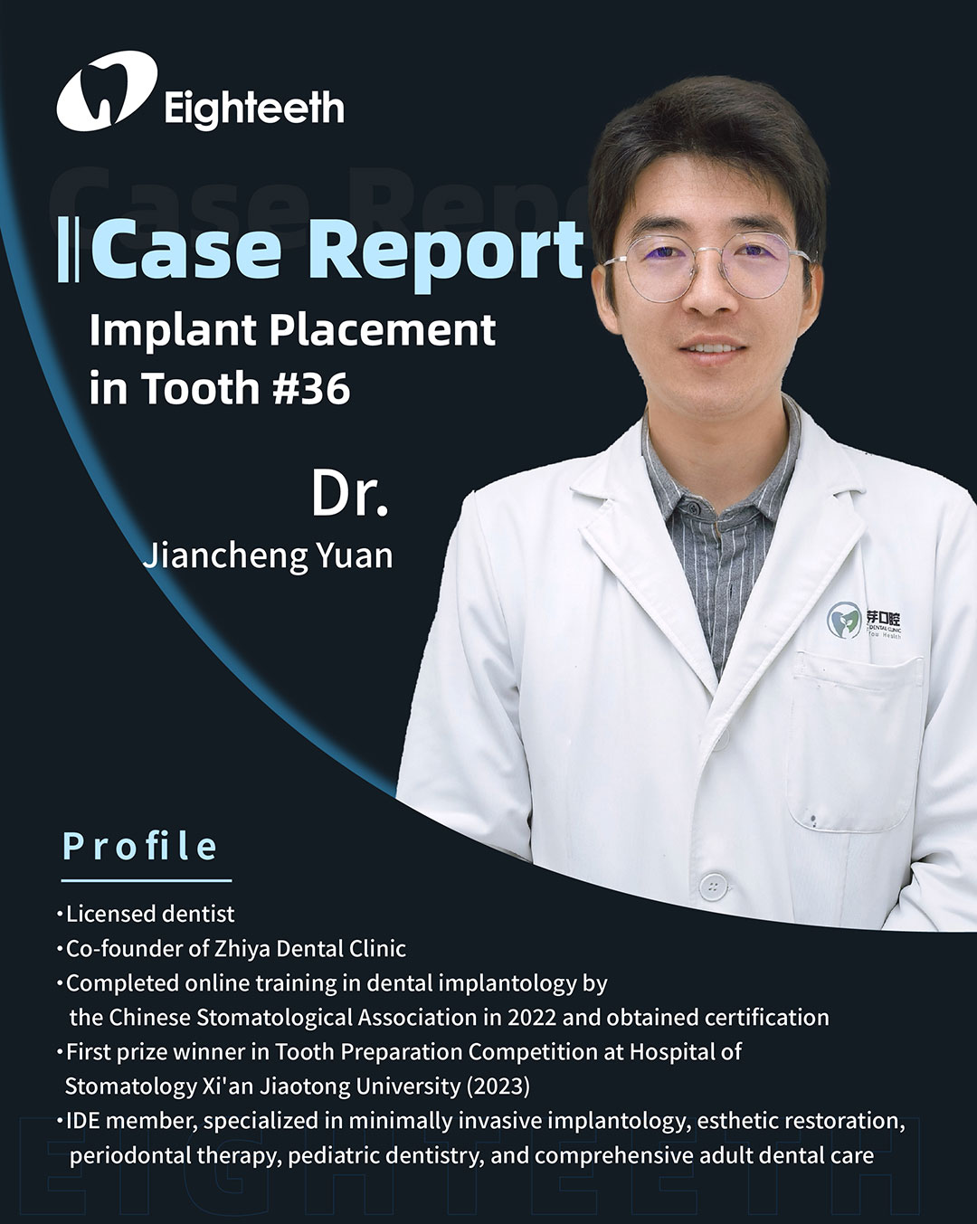 Implant Placement in Tooth #36 1_1