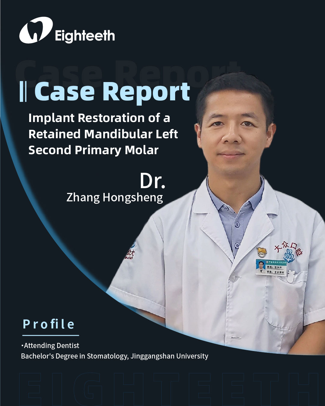 Implant Restoration of a Retained Mandibular Left Second Primary Molar1_1