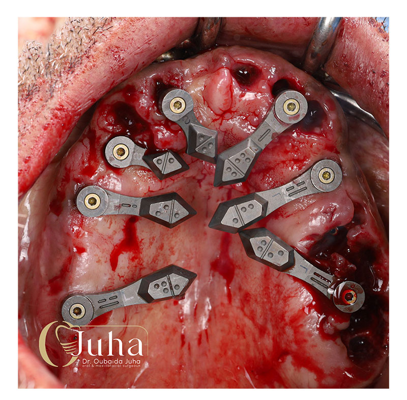 Eighteeth-Digital-Casebook-4-1