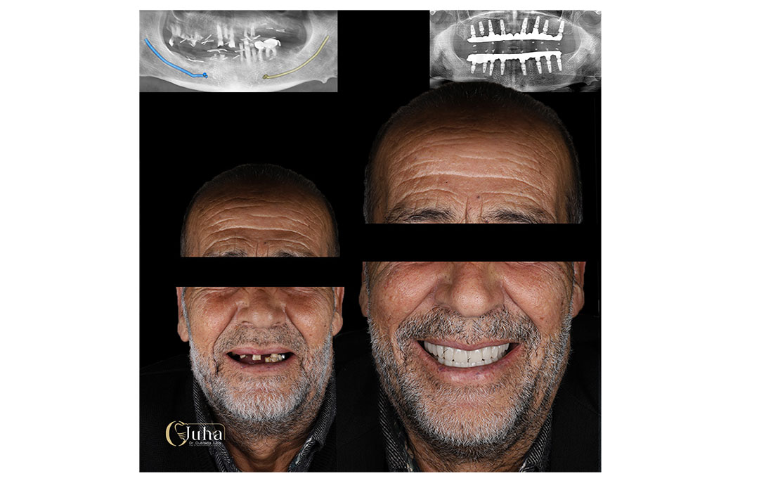 Eighteeth-Digital-Casebook-8